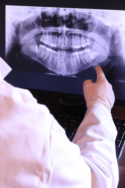 Best Emergency Wisdom Teeth Removal in Prospect Rk, PA