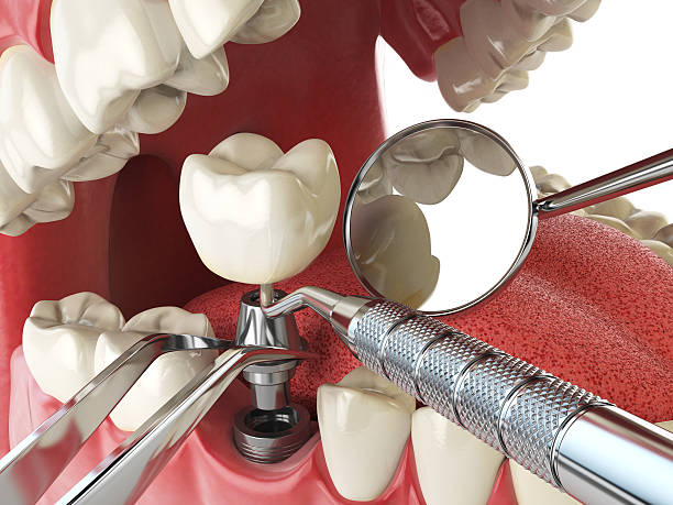 Best Urgent Care for Lost Fillings or Crowns in Prospect Rk, PA